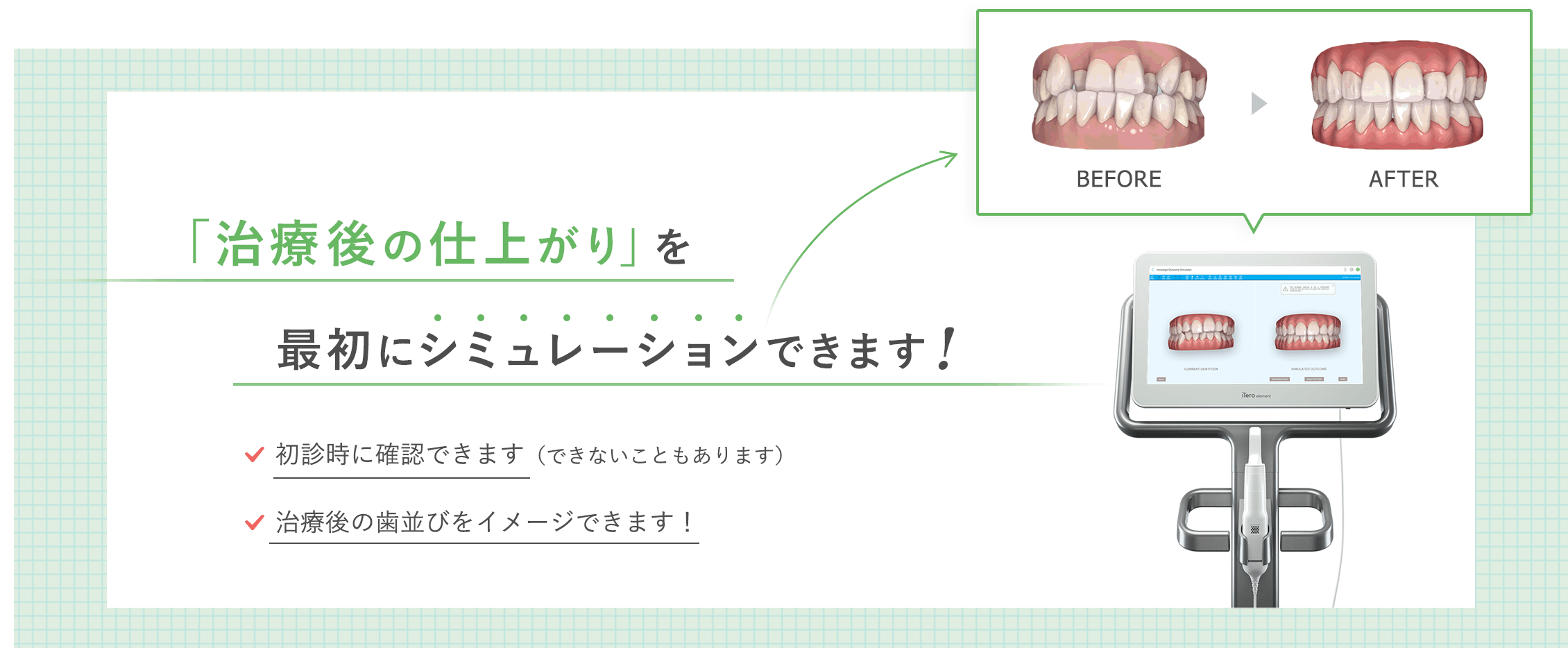 治療の仕上がりを最初にシミュレーションできます！