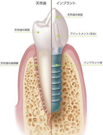 噛み合わせ